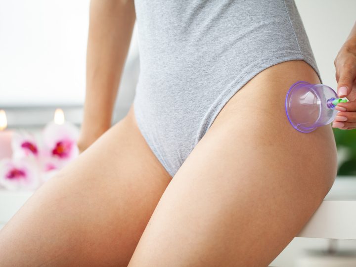 Dieta anticellulite: benefici ed esempio di menu